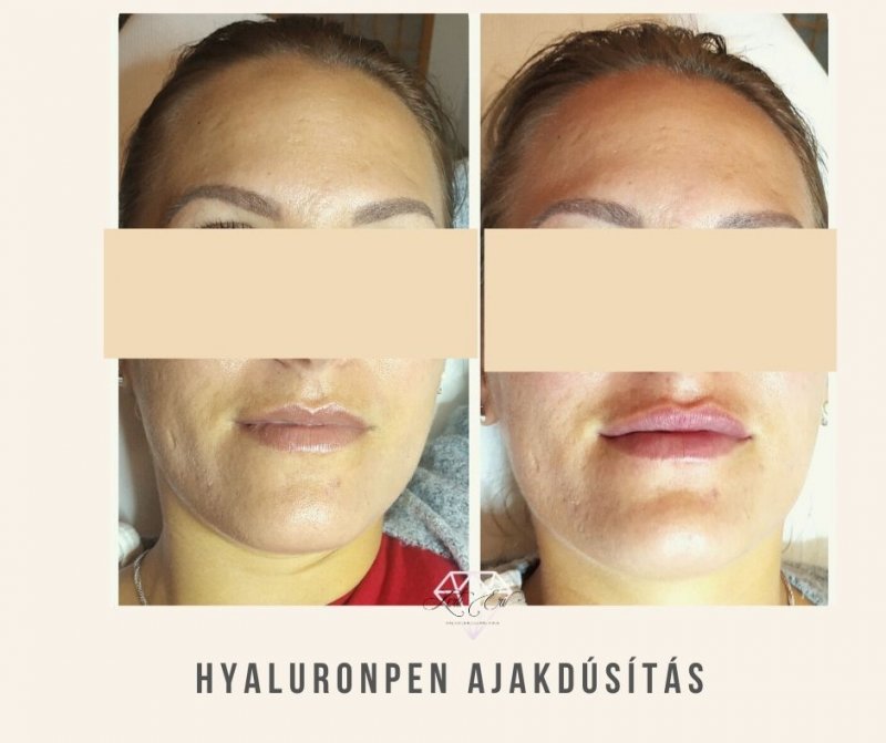 anti aging arc rutin