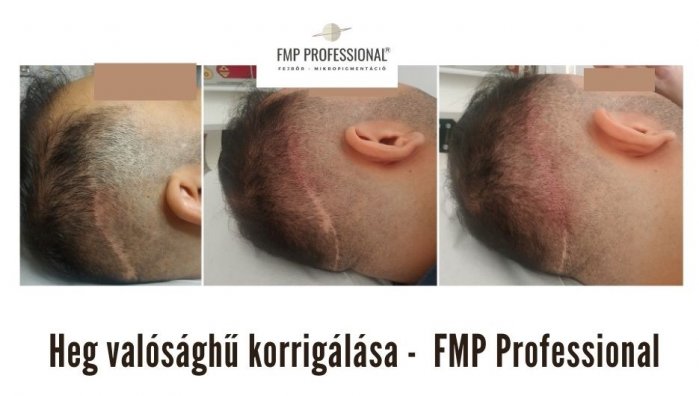 kopasz heg fejbortetovalas